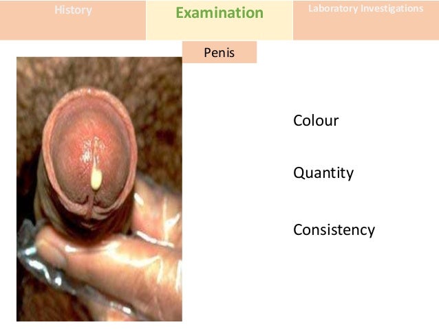 mucous discharge penis Sex toys store com